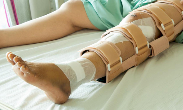 Thực hiện tập co cơ tĩnh khi đang bất động khớp